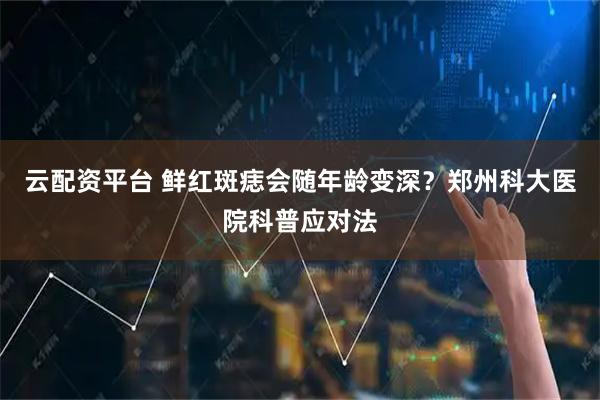 云配资平台 鲜红斑痣会随年龄变深？郑州科大医院科普应对法